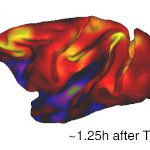 Healing neurological disorders with ultrasound