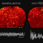 Best Poster Award at a Brain Conference organized by the FENS