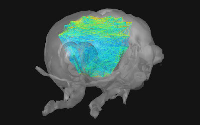 New publication in Nature Methods on 4D functional ultrasound imaging