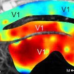 New advances in functional ultrasound imaging for neuroscience