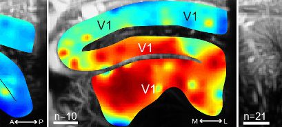New advances in functional ultrasound imaging for neuroscience