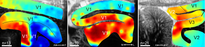 New advances in functional ultrasound imaging for neuroscience New advances in functional ultrasound imaging for neuroscience