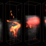 Ultrasound angiography of coronaries goes 3D