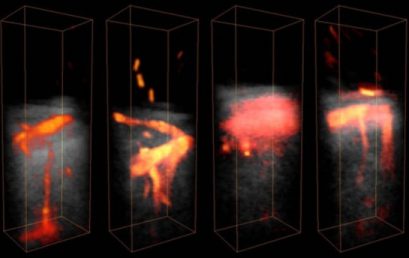 Ultrasound angiography of coronaries goes 3D