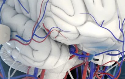Transcranial super-localization imaging of the adult brain in the Best Of EMIM Talks 2020