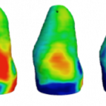 3D ultrafast echocardiography: full characterization of cardiac functions within a heartbeat