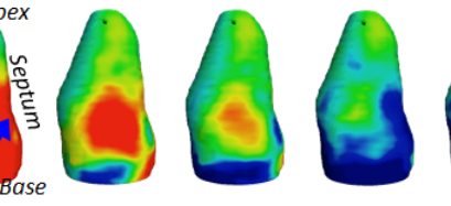 3D ultrafast echocardiography: full characterization of cardiac functions within a heartbeat