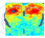 Pharmaco-fUS: How Ultrasound could foster drug discovery in neuroscience