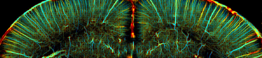The latest news on ultrasound for neurosciences featured in The Conversation The latest news on ultrasound for neurosciences featured in The Conversation