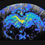 How does the brain activity change during repetitive behaviours?