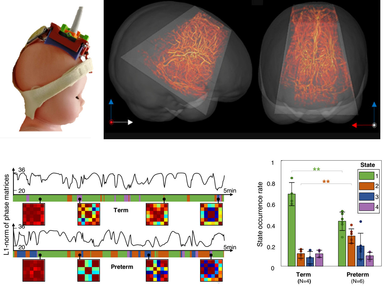Functional ultrasound imaging reveals the dynamics of brain states in