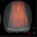 Functional ultrasound imaging reveals the dynamics of brain states in preterm babies