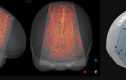 Functional ultrasound imaging reveals the dynamics of brain states in preterm babies