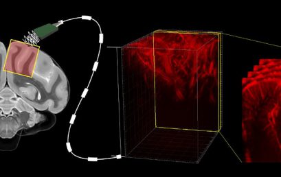 Functional ultrasound as a read-out for brain-machine interfaces