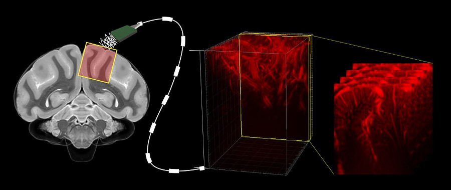 Functional ultrasound as a read-out for brain-machine interfaces