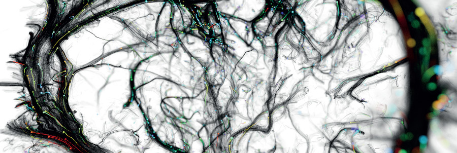 3D ultrasound microscopy of the brain on the front cover of eBioMedicine