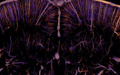 Functional ultrasound microscopy: sensing the whole brain neuronal activity at the micron scale