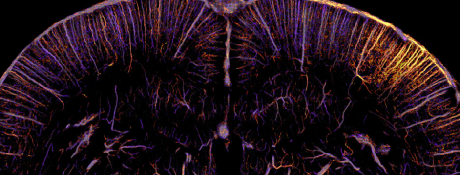 Functional ultrasound microscopy: sensing the whole brain neuronal activity at the micron scale