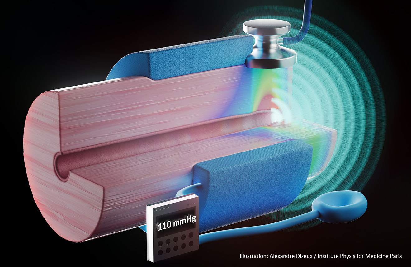 Korotkoff sounds: a century-old enigma of physics is finally solved