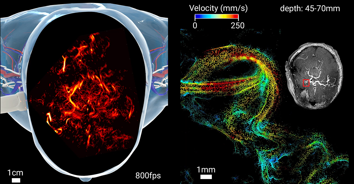 Imaging the brain through the skull: a comprehensive review Imaging the brain through the skull: a comprehensive review