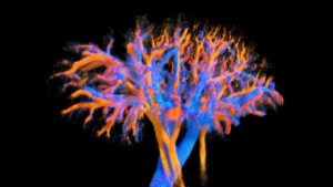 For the first time, whole-organ blood flow dynamics can be mapped at micrometric resolution using an ultrasound multi-lens probe — demonstrated in vivo in the heart, kidney, and liver.