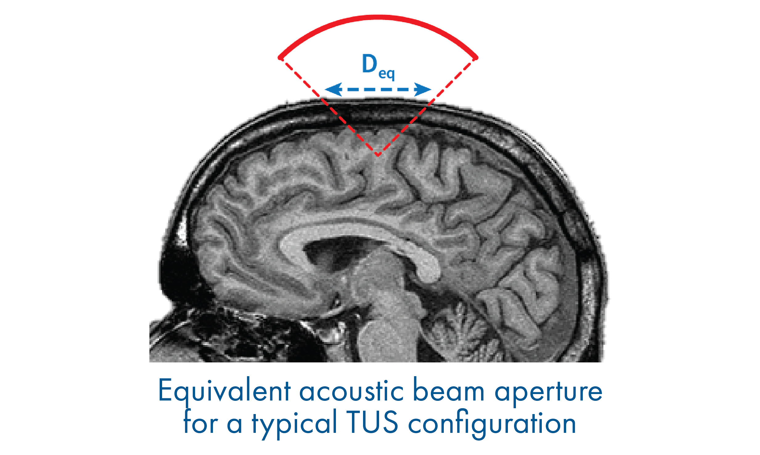 Toward global safety standards for transcranial ultrasound stimulation: new publication in Brain Stimulation Toward global safety standards for transcranial ultrasound stimulation: new publication in Brain Stimulation