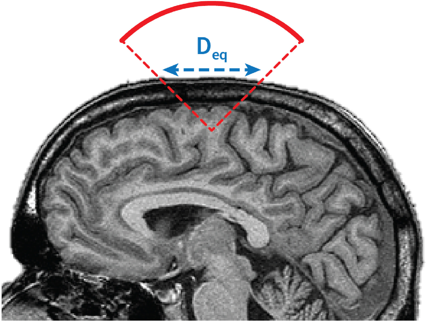 Toward global safety standards for transcranial ultrasound stimulation: new publication in Brain Stimulation Toward global safety standards for transcranial ultrasound stimulation: new publication in Brain Stimulation