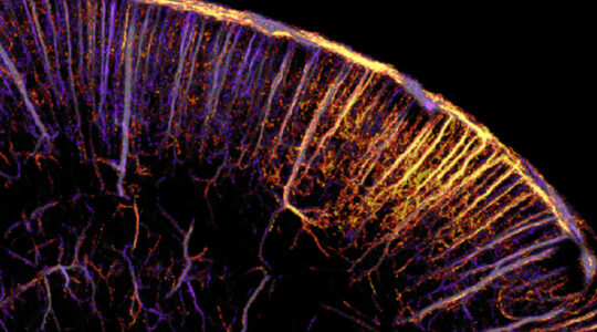 fUSbrain_carrousel_renaudin2022