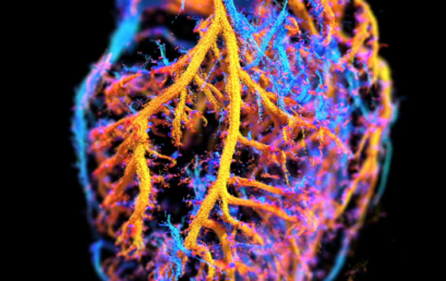 Stage – Algorithme haute performance de reconstruction pour l’échographie 3D ultrarapide