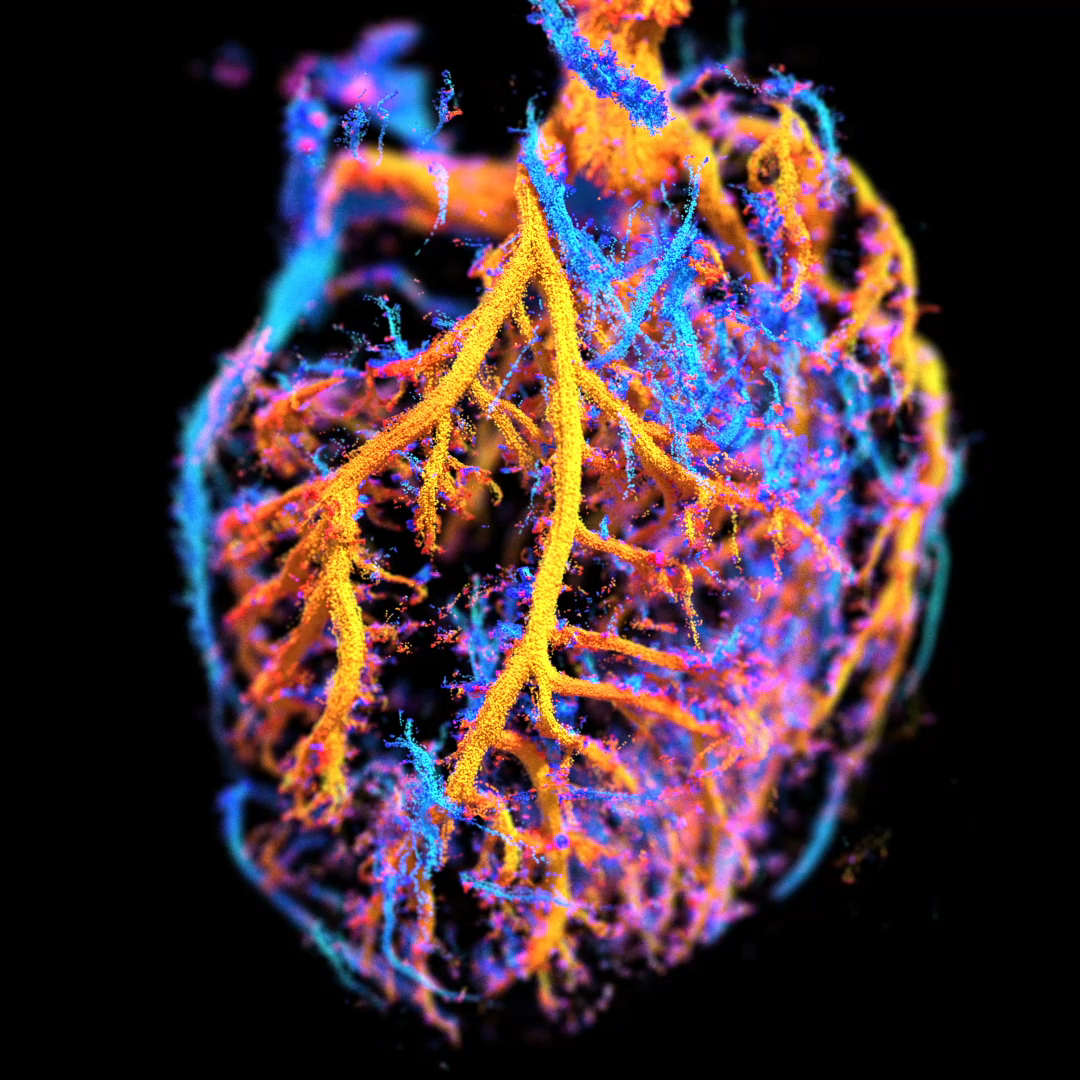 Stage – Algorithme haute performance de reconstruction pour l’échographie 3D ultrarapide