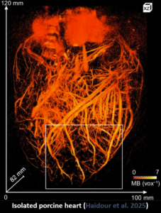 Internship - Design and testing of hydrogel prototypes for improved skin-probe coupling in ultrasound imaging