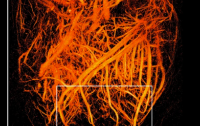 Internship – Design and testing of hydrogel prototypes for improved skin-probe coupling in ultrasound imaging