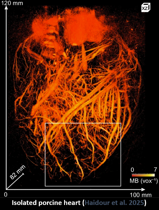 Internship – Design and testing of hydrogel prototypes for improved skin-probe coupling in ultrasound imaging