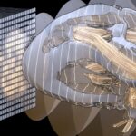 4D Ultrafast Ultrasound: the next revolution in biomedical imaging