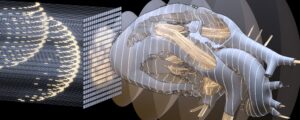 Our researcher Clément Papadacci has just published a review with an international group of leading researchers in the field.
