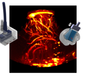 Neuroimaging in Neonates using Functional Ultrasound (fUS)