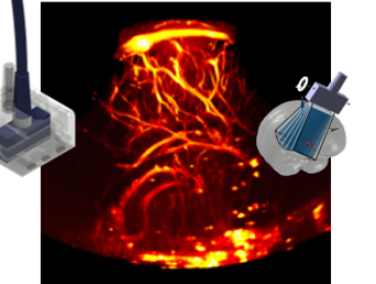 Neuroimaging in Neonates using Functional Ultrasound (fUS)